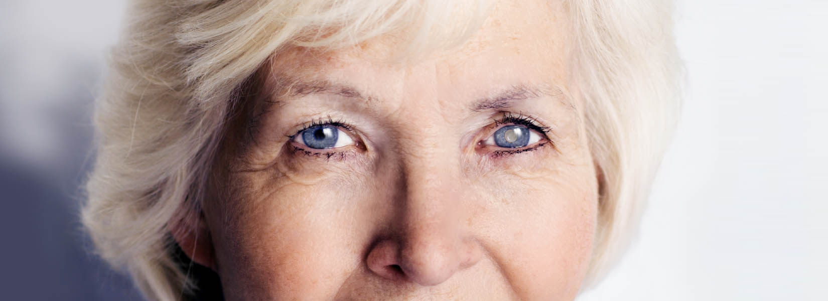 Cataract Surgery in Pearsall